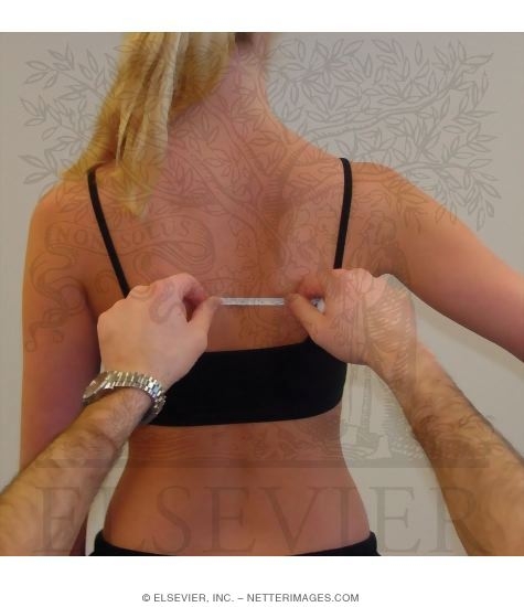 Detecting Scapular Asymmetry During Static and Dynamic Activity: Lateral Slide Test Position 2