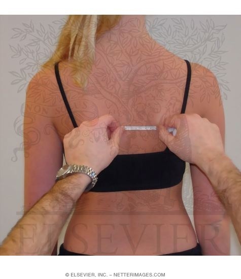 Detecting Scapular Asymmetry During Static and Dynamic Activity: Lateral Slide Test Position 1