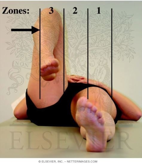 Flexion-Adduction Test