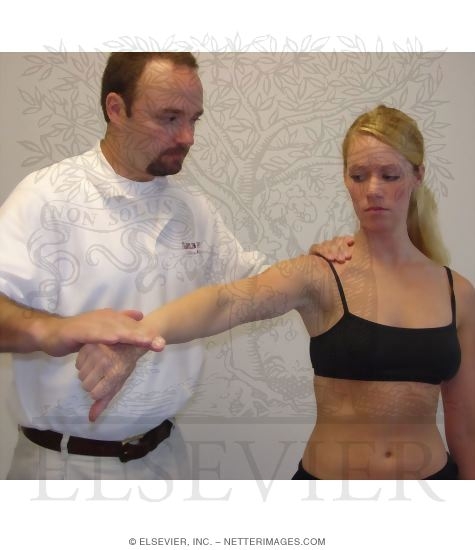 Supraspinatus Tear: Empty Can