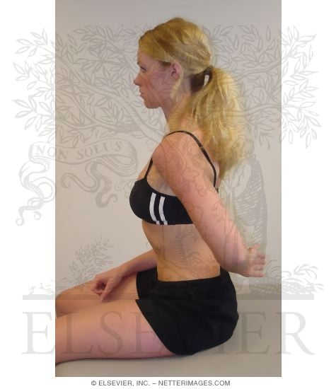 Subscapularis Tears: Internal Rotation Lag Sign, Negative Test