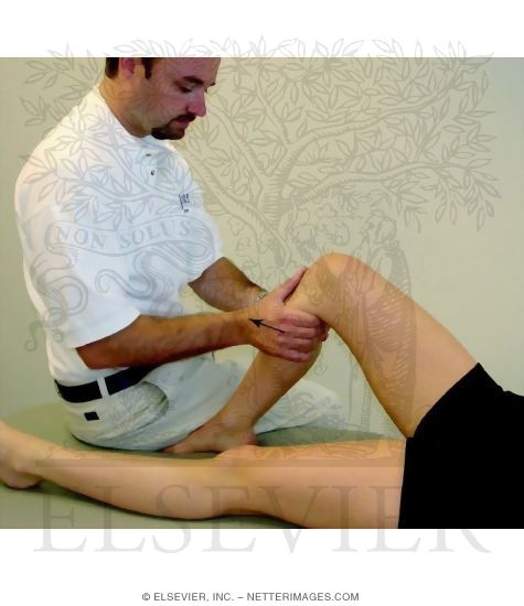 Detecting Anterior Cruciate Ligament Ruptures: The Anterior Drawer Test