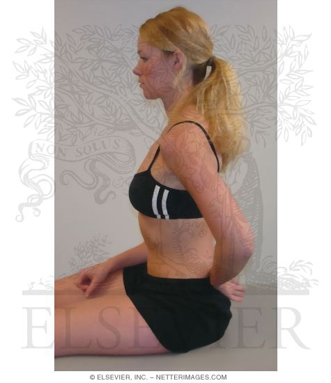 Subscapularis Tears: Internal Rotation Lag Sign, Positive Test