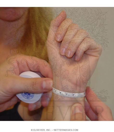 Watermarked preview of unlabeled image: Figure-of-Eight and Volumetric Measurements of Hand: Start