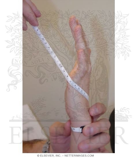 Watermarked preview of unlabeled image: Figure-of-Eight and Volumetric Measurements of Hand: Step 2