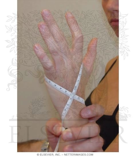 Figure-of-Eight and Volumetric Measurements of Hand: Completed