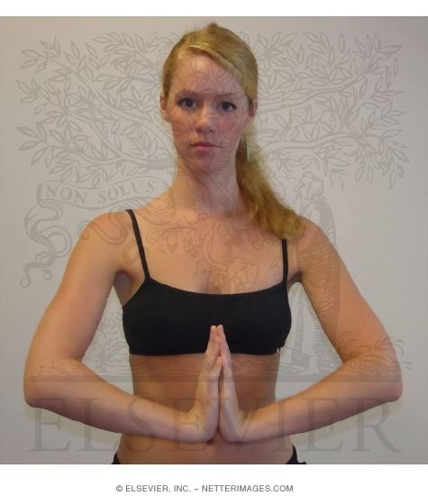 Carpal Tunnel Syndrome: Wrist Extension Test