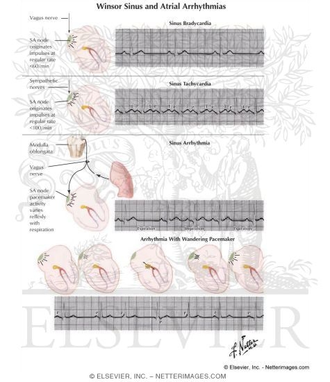 Sinus and Atrial Arrhythmias