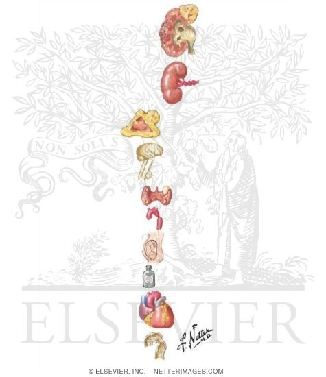 Watermarked preview of unlabeled image: Causes of Hypertension