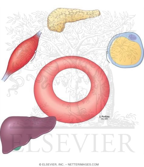 Watermarked preview of unlabeled image: Type 2 Diabetes Mellitus