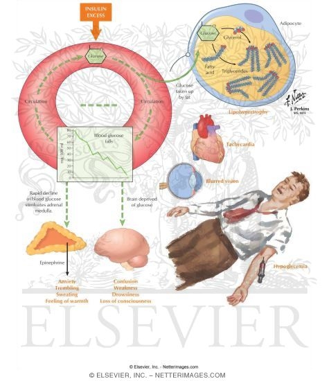 Watermarked preview of labeled image: Reactions to Insulin: Hypoglycemia and Adipose Tissue Changes