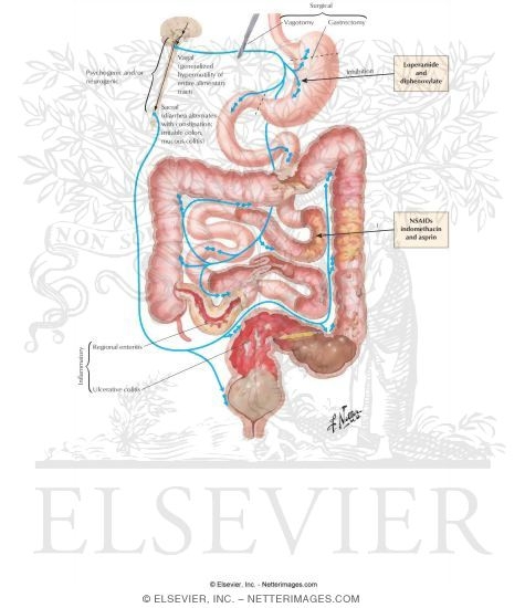 Watermarked preview of labeled image: Antidiarrheal Drugs and Their Adverse Effects