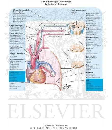 Watermarked preview of labeled image: Sites of Pathologic Disturbances in Control of Breathing