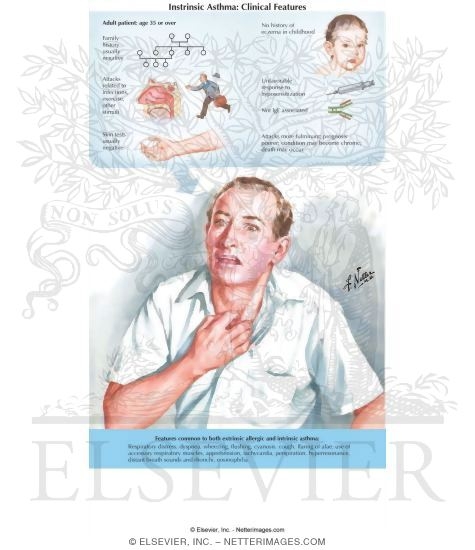 Intrinsic Asthma: Clinical Features