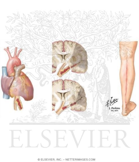 Estrogen and Coagulation