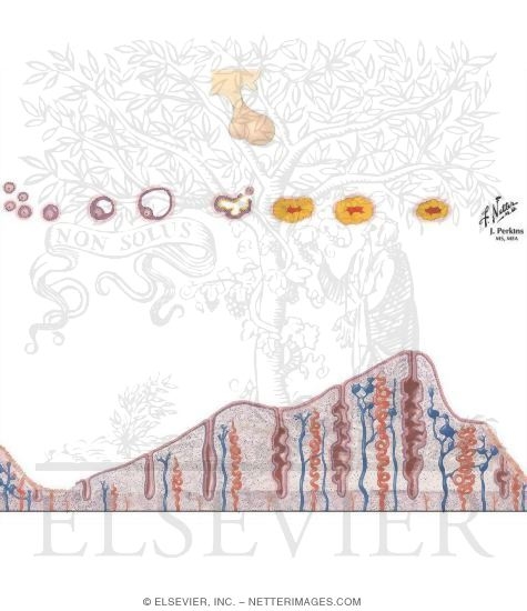 Watermarked preview of unlabeled image: Progestin-Only Contraceptives