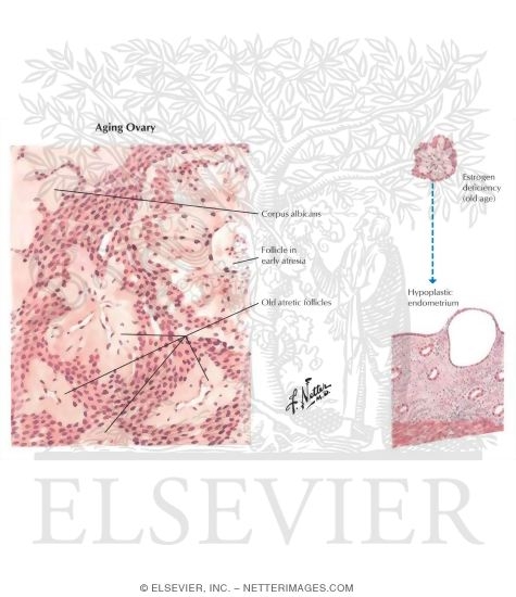Watermarked preview of labeled image: Genitourinary Atrophy