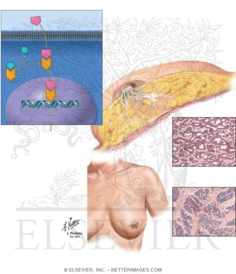 Watermarked preview of unlabeled image: Cancer Risks