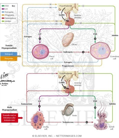 Watermarked preview of labeled image: Hypogonadism Treatment and Adverse Effects
