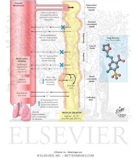 Watermarked preview of labeled image: Loop (High-Ceiling) Diuretics
