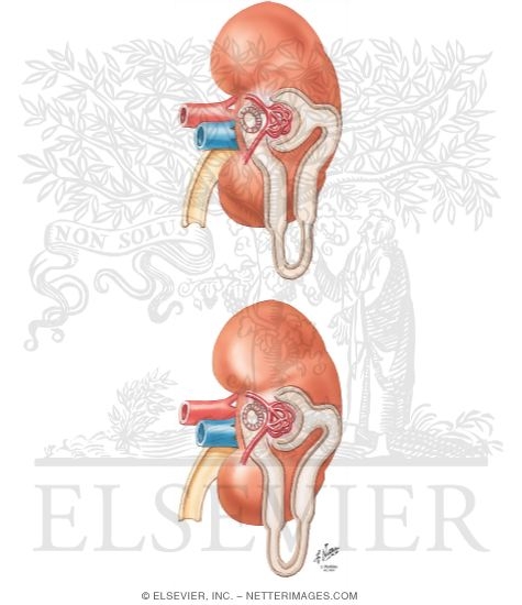 Watermarked preview of unlabeled image: Effect of Renal Insufficiency On Drug Action