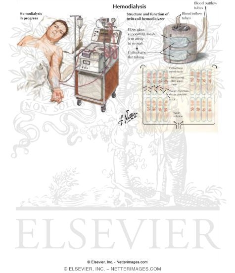 Watermarked preview of labeled image: Hemodialysis