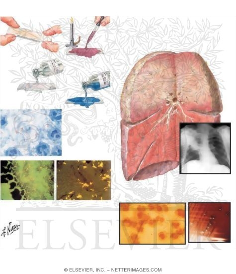 Watermarked preview of unlabeled image: Examples of Resistance