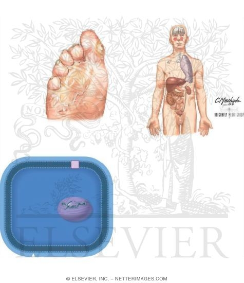 Watermarked preview of unlabeled image: Nature of Fungal Infections and Therapy