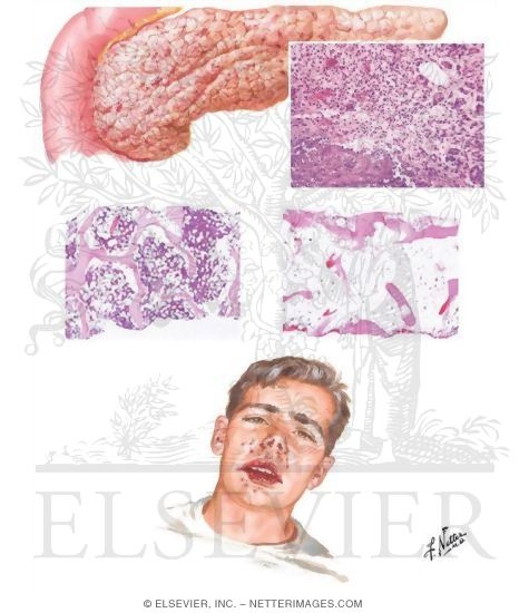 Watermarked preview of unlabeled image: Nucleoside Reverse Transcriptase Inhibitors (NRTIs) and Non-NRTIs