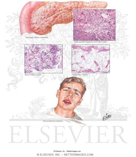 Watermarked preview of labeled image: Nucleoside Reverse Transcriptase Inhibitors (NRTIs) and Non-NRTIs
