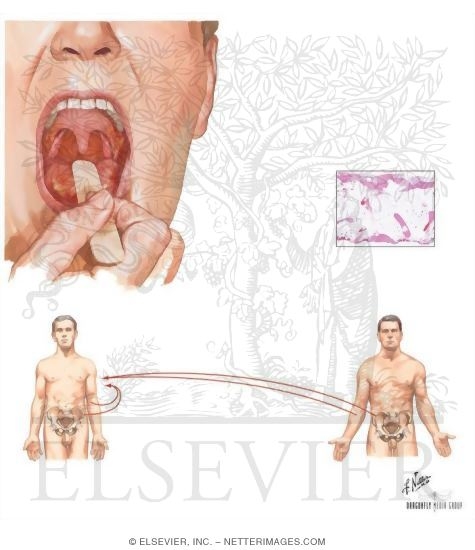Watermarked preview of unlabeled image: Adverse Effects of Chemotherapy