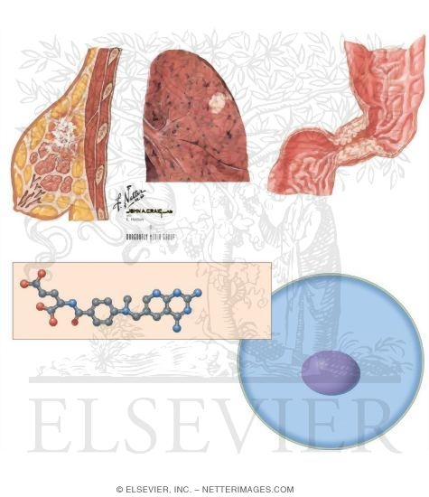 Watermarked preview of unlabeled image: Folate Analogs: Methotrexate