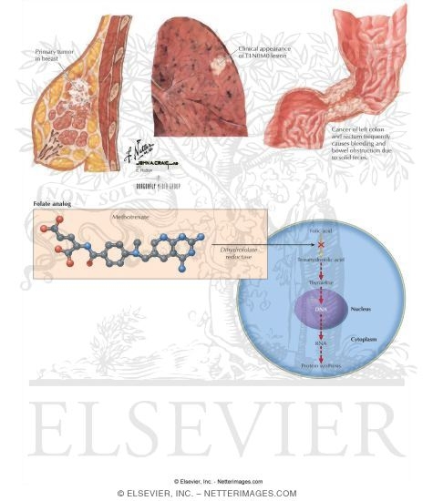 Watermarked preview of labeled image: Folate Analogs: Methotrexate
