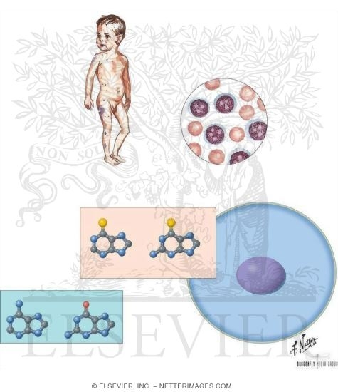 Watermarked preview of unlabeled image: Purine Analogs: Mercaptopurine and Thioguanine