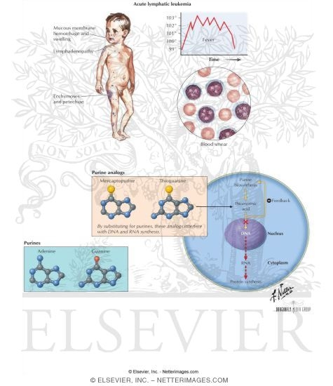 Watermarked preview of labeled image: Purine Analogs: Mercaptopurine and Thioguanine