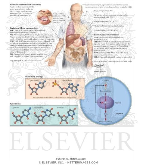 Watermarked preview of labeled image: Pyrimidine Analogs: Cytarabine and Fludarabine