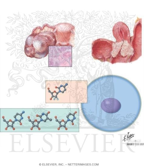 Watermarked preview of unlabeled image: Pyrimidine Analogs: Gemcitabine