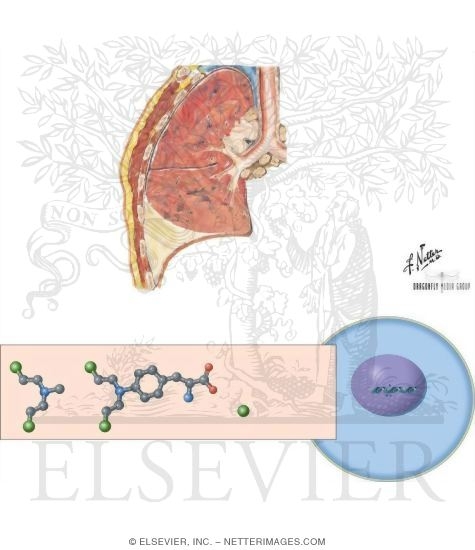 Watermarked preview of unlabeled image: Nitrogen Mustards: Mecholorthamine and Melphalan