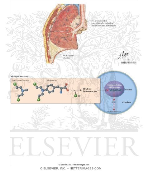 Watermarked preview of labeled image: Nitrogen Mustards: Mecholorthamine and Melphalan