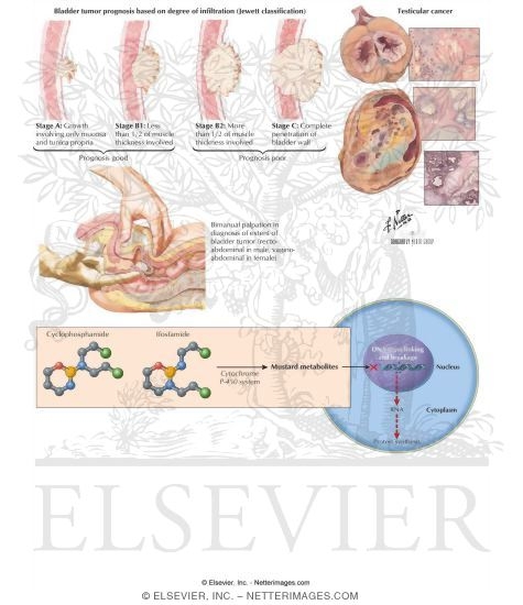 Watermarked preview of labeled image: Cyclophosphamide and Ifosfamide