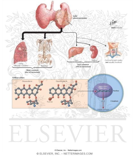 Anthracyclines: Doxorubicin and Daunorubicin