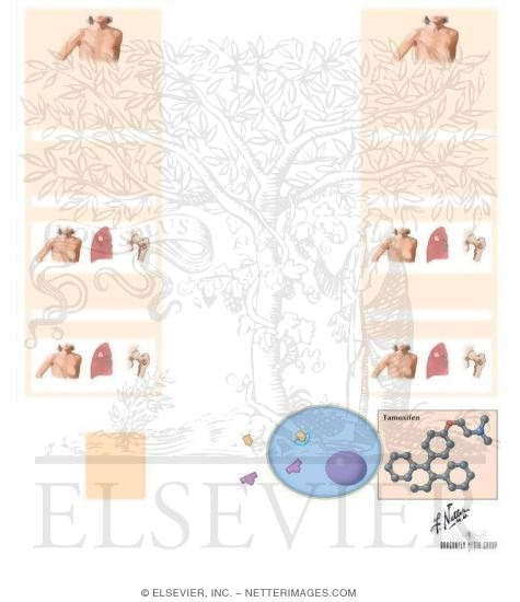 Watermarked preview of unlabeled image: Estrogen Antagonists: Tamoxifen and Toremifene