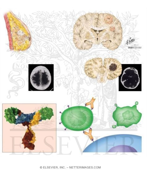 Watermarked preview of unlabeled image: Unconjugated Antibodies: Trastuzumab, Alemtuzumab, and Rituximab