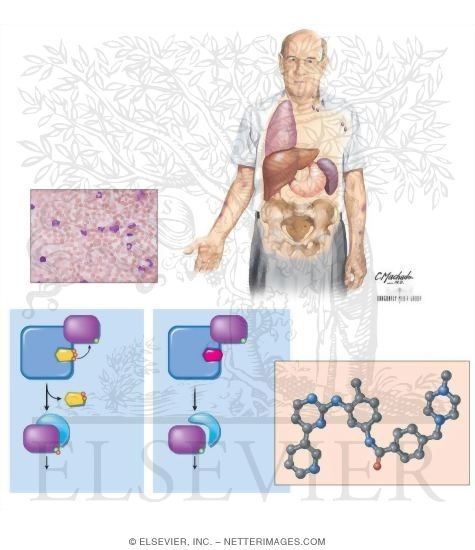 Watermarked preview of unlabeled image: Imatinib Mesylate