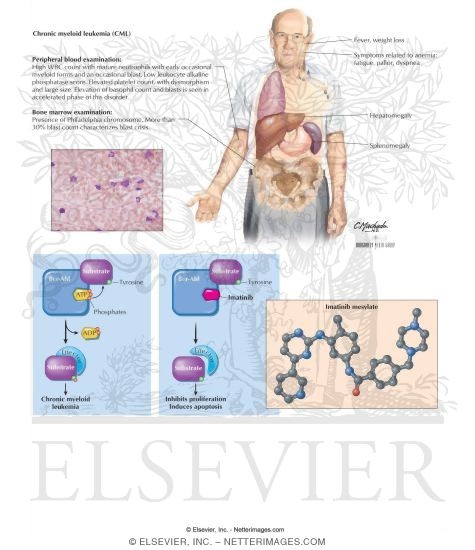 Watermarked preview of labeled image: Imatinib Mesylate
