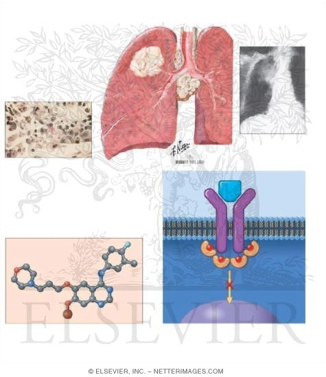Watermarked preview of unlabeled image: Gefitinib