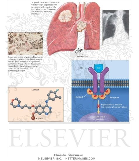Watermarked preview of labeled image: Gefitinib