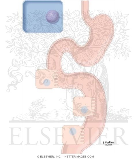 Watermarked preview of unlabeled image: Water-Soluable Vitamin-Drug Interactions