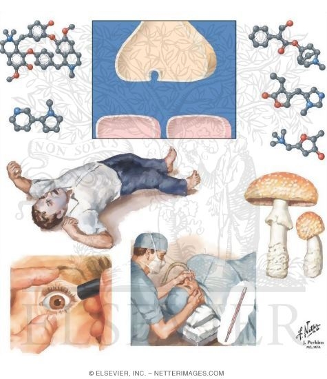 Anticholinergic Drugs