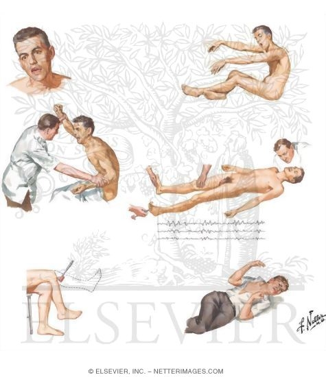 Watermarked preview of unlabeled image: Serotonergics